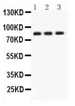 Invitrogen Apolipoprotein J Polyclonal Antibody 100 &mu;g; Unconjugated:Antibodies,