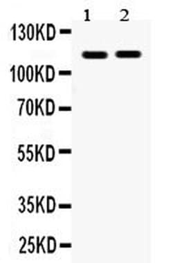EphA5 Polyclonal Antibody:Antibodies, Polyclonal