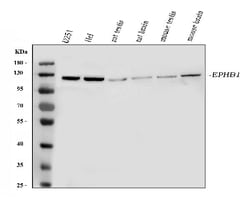 Invitrogen EphB1 Polyclonal Antibody 100 &mu;g; Unconjugated:Antibodies,