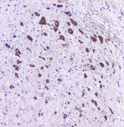 HTR2A Polyclonal Antibody, Invitrogen 100 &mu;g; Unconjugated:Antibodies,