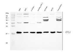 Invitrogen Cofilin Polyclonal Antibody 100 &mu;g; Unconjugated:Antibodies,