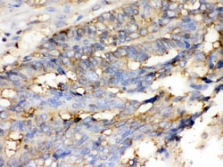 Invitrogen Cofilin Polyclonal Antibody 100 &mu;g; Unconjugated:Antibodies,