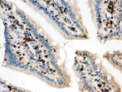 Invitrogen Cofilin Polyclonal Antibody 100 &mu;g; Unconjugated:Antibodies,