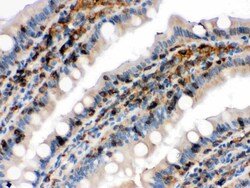 Invitrogen Cofilin Polyclonal Antibody 100 &mu;g; Unconjugated:Antibodies,