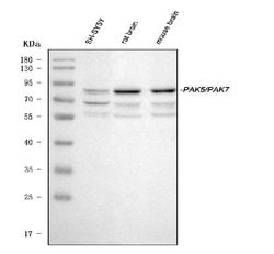 Invitrogen PAK7 Polyclonal Antibody 100 &mu;g; Unconjugated:Antibodies,