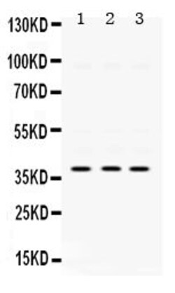 Invitrogen AMPK beta-1 Polyclonal Antibody 100 &mu;g; Unconjugated:Antibodies,