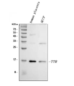 Invitrogen Transthyretin Polyclonal Antibody 100 &mu;g; Unconjugated:Antibodies,