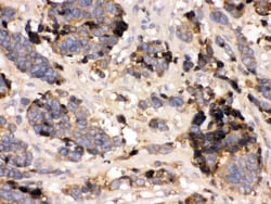 Invitrogen Transthyretin Polyclonal Antibody 100 &mu;g; Unconjugated:Antibodies,