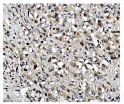 Invitrogen OGT Polyclonal Antibody 100 &mu;g | Buy Online | Invitrogen&trade; | Fisher Scientific