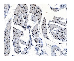 Invitrogen OGT Polyclonal Antibody 100 &mu;g | Buy Online | Invitrogen&trade; | Fisher Scientific
