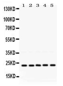 Invitrogen RAB18 Polyclonal Antibody 100 &mu;g; Unconjugated:Antibodies,