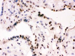 Invitrogen RbAp48 Polyclonal Antibody 100 &mu;g; Unconjugated:Antibodies,