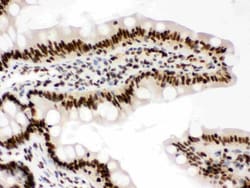 Invitrogen RbAp48 Polyclonal Antibody 100 &mu;g; Unconjugated:Antibodies,