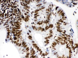 Invitrogen RbAp48 Polyclonal Antibody 100 &mu;g; Unconjugated:Antibodies,