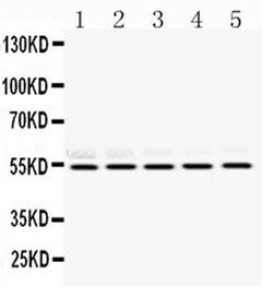 Invitrogen RbAp48 Polyclonal Antibody 100 &mu;g; Unconjugated:Antibodies,