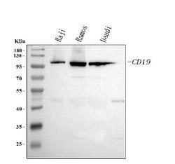 Invitrogen CD19 Polyclonal Antibody 100 &mu;g; Unconjugated:Antibodies,