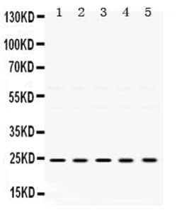 Invitrogen TIMP2 Polyclonal Antibody 100 &mu;g; Unconjugated:Antibodies,