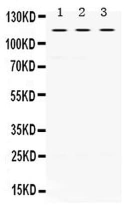 Invitrogen UNC5C Polyclonal Antibody 100 &mu;g; Unconjugated:Antibodies,