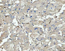 Invitrogen CD14 Polyclonal Antibody 100 &mu;g; Unconjugated:Antibodies,