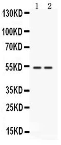 Invitrogen CD14 Polyclonal Antibody 100 &mu;g; Unconjugated:Antibodies,