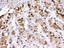Invitrogen Ceruloplasmin Polyclonal Antibody 100 &mu;g; Unconjugated:Antibodies,