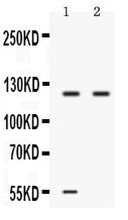 Invitrogen Ceruloplasmin Polyclonal Antibody 100 &mu;g; Unconjugated:Antibodies,
