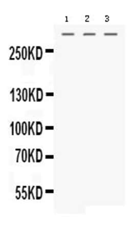Invitrogen MGA Polyclonal Antibody 100 &mu;g | Buy Online | Invitrogen&trade; | Fisher Scientific
