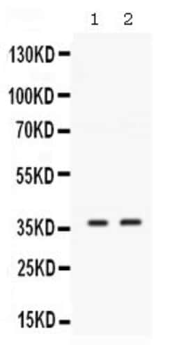Invitrogen SIX1 Polyclonal Antibody 100 &mu;g; Unconjugated:Antibodies,
