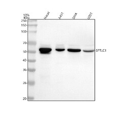 Invitrogen SPTLC1 Polyclonal Antibody 100 &mu;g | Buy Online | Invitrogen&trade; | Fisher Scientific