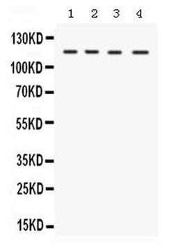 UBE1 Polyclonal Antibody:Antibodies, Polyclonal