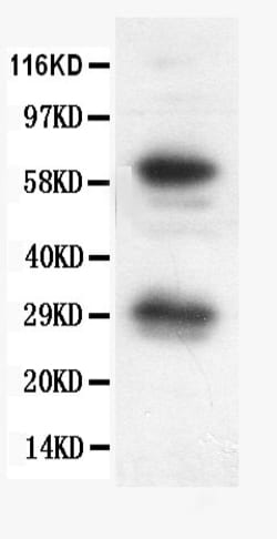 Invitrogen Bcl-X Polyclonal Antibody 100 &mu;g; Unconjugated:Antibodies,