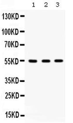 Invitrogen ILK Polyclonal Antibody 100 &mu;g; Unconjugated:Antibodies,
