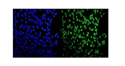 Invitrogen MEF2A Polyclonal Antibody 100 &mu;g | Buy Online | Invitrogen&trade; | Fisher Scientific