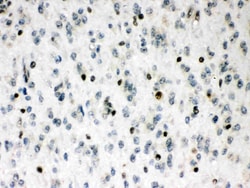 Invitrogen MEF2A Polyclonal Antibody 100 &mu;g | Buy Online | Invitrogen&trade; | Fisher Scientific