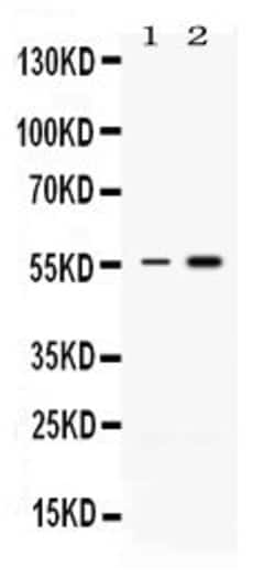 Invitrogen MEF2A Polyclonal Antibody 100 &mu;g | Buy Online | Invitrogen&trade; | Fisher Scientific