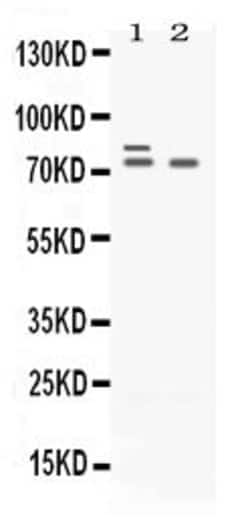 Invitrogen PLZF Polyclonal Antibody 100 &mu;g; Unconjugated:Antibodies,