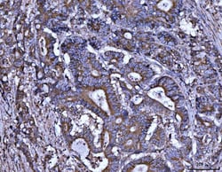 Invitrogen ALDH1A2 Polyclonal Antibody 100 &mu;g; Unconjugated:Antibodies,