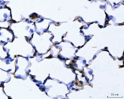 Invitrogen ALDH1A2 Polyclonal Antibody 100 &mu;g; Unconjugated:Antibodies,