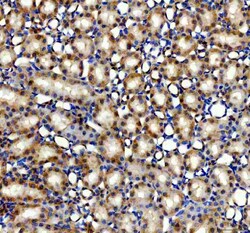 Invitrogen AMACR Polyclonal Antibody 100 &mu;g | Buy Online | Invitrogen&trade; | Fisher Scientific