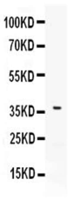 Invitrogen CD273 (B7-DC) Polyclonal Antibody 100 &mu;g; Unconjugated:Antibodies,