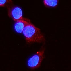 Invitrogen ACVR2A Polyclonal Antibody 100 &mu;g; Unconjugated:Antibodies,