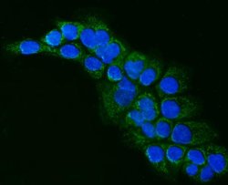 Invitrogen ALDH1B1 Polyclonal Antibody 100 &mu;g; Unconjugated:Antibodies,