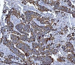 Invitrogen ALDH1B1 Polyclonal Antibody 100 &mu;g; Unconjugated:Antibodies,