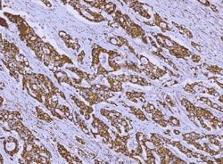 Invitrogen ALDH1B1 Polyclonal Antibody 100 &mu;g; Unconjugated:Antibodies,