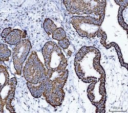 Invitrogen ALDH1B1 Polyclonal Antibody 100 &mu;g; Unconjugated:Antibodies,
