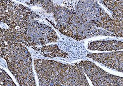 Invitrogen ALDH1B1 Polyclonal Antibody 100 &mu;g; Unconjugated:Antibodies,