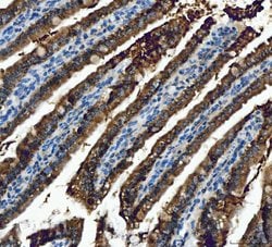 Invitrogen ALDH1B1 Polyclonal Antibody 100 &mu;g; Unconjugated:Antibodies,