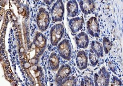 Invitrogen ALDH1B1 Polyclonal Antibody 100 &mu;g; Unconjugated:Antibodies,