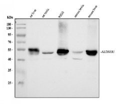 Invitrogen ALDH1B1 Polyclonal Antibody 100 &mu;g; Unconjugated:Antibodies,