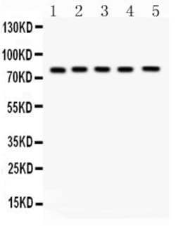 Invitrogen FSHR Polyclonal Antibody 100 &mu;g; Unconjugated:Antibodies,